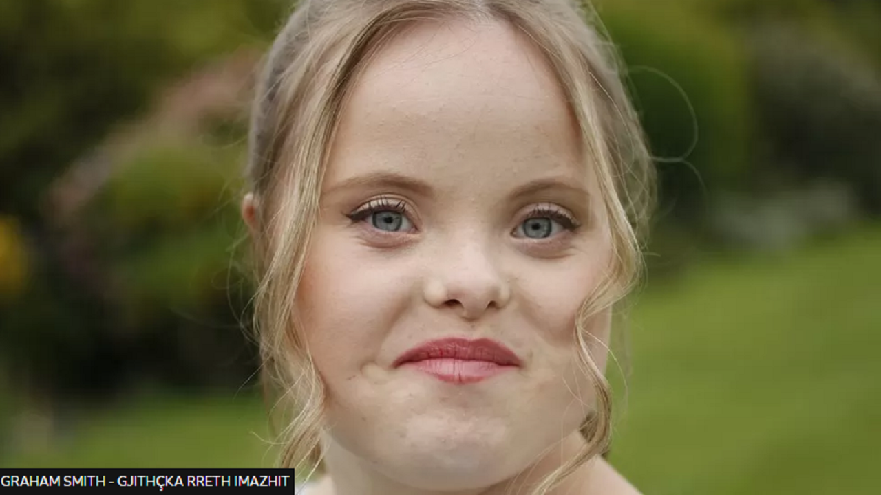 The model with Down syndrome aims to change the way the fashion industry looks